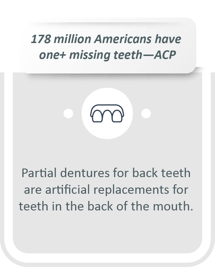 Partial dentures for back teeth infographic: Partial dentures for back teeth are artificial replacements for teeth in the back of the mouth.