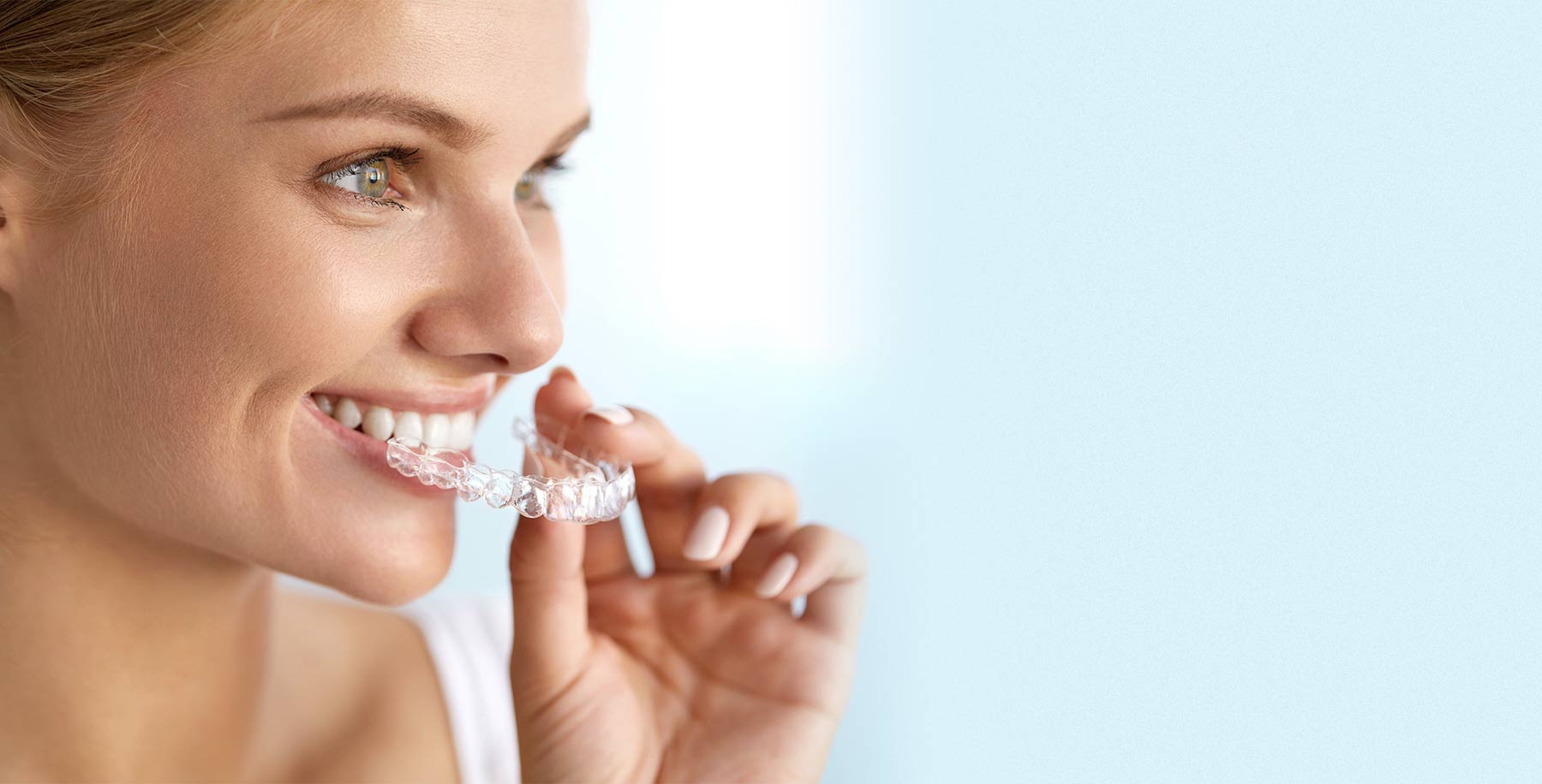 2024 Diamond Invisalign Provider