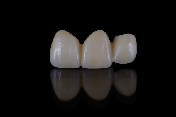 What Is A Porcelain Fixed Bridge?