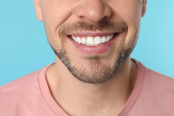 Ask A Cosmetic Dentist: Bonding Vs  Veneers