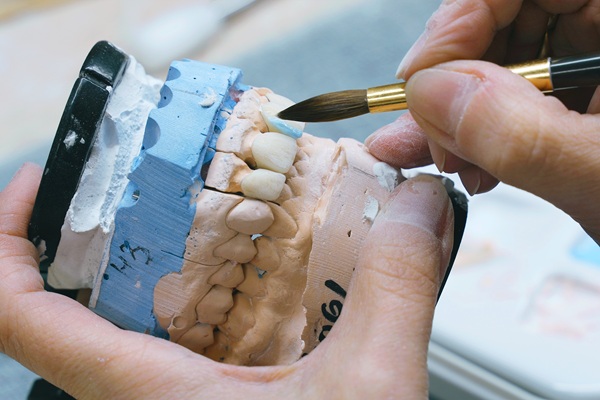 When To Consider A Full Mouth Reconstruction