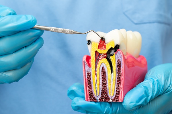 When Root Canal Retreatment Is An Emergency