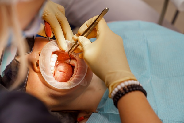 Wisdom Teeth Extractions: When, Why, And What To Expect